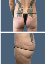 After body