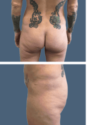 Before body
