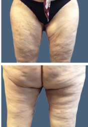 After body