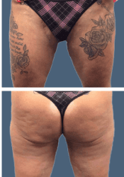 After body