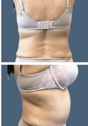 After body